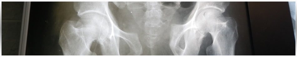 Pelvic Pain - Kyle Dickson