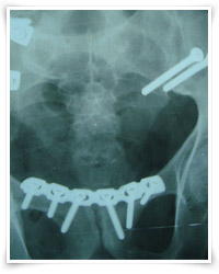 Common Injuries Treated by Dr Dickson Graphic